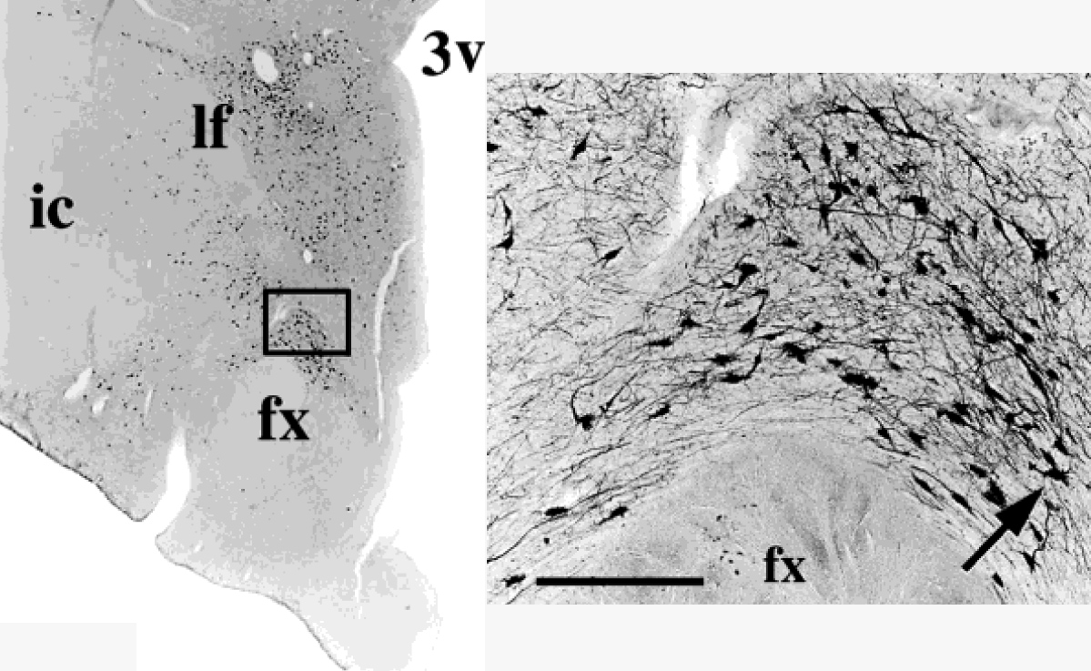 Open Mch File Research | Clifford-Saper