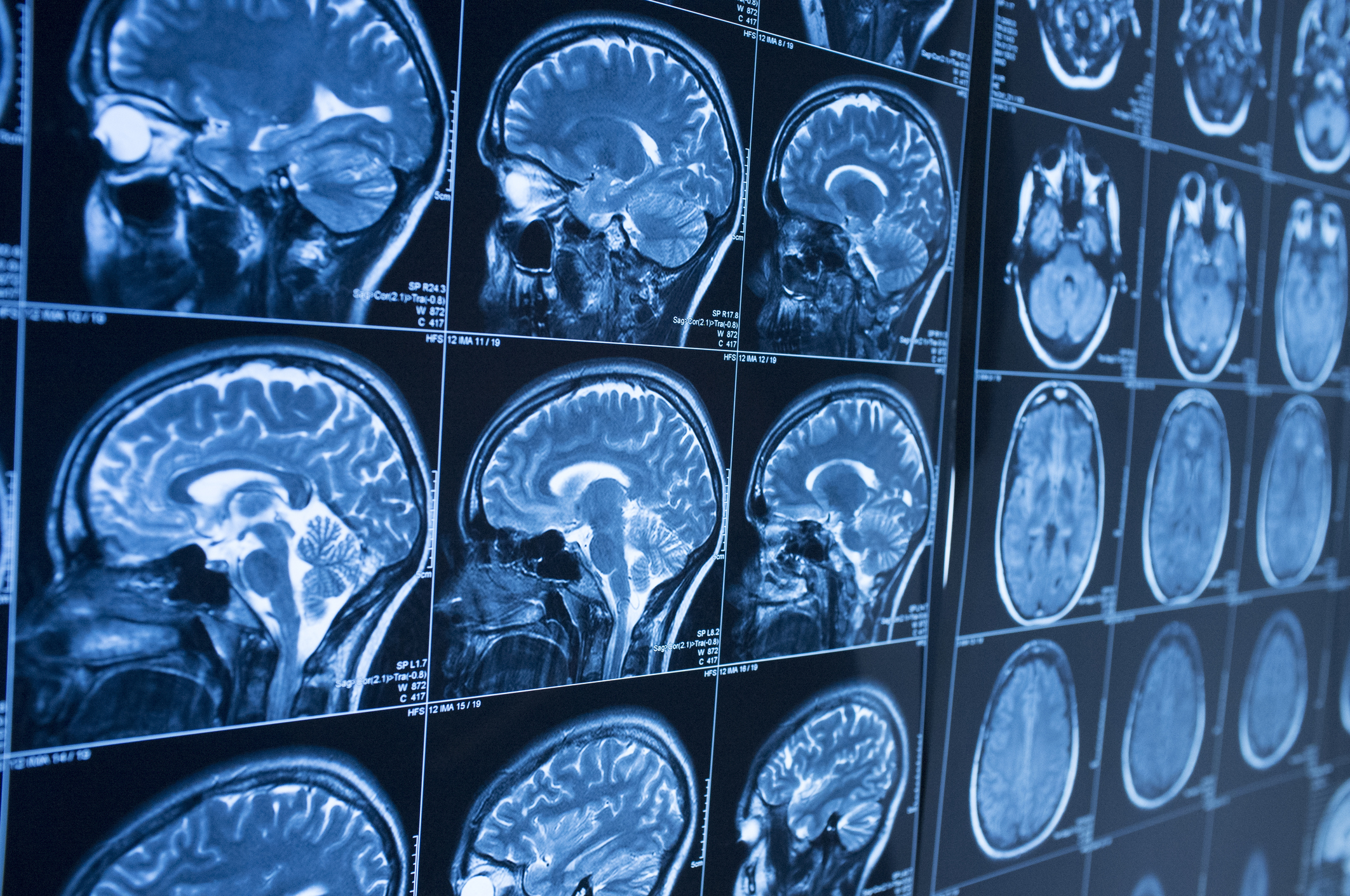 Brain Scans