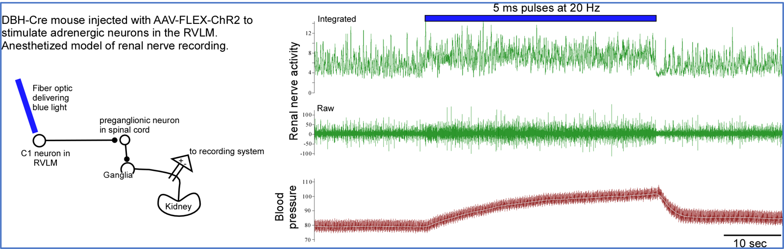 precise brain stimulation raises blood pressure laser stimulation of light sensitive cells in brain causes blood pressure rise