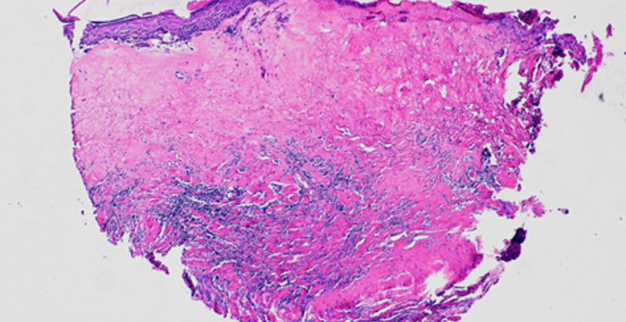 IHC Image