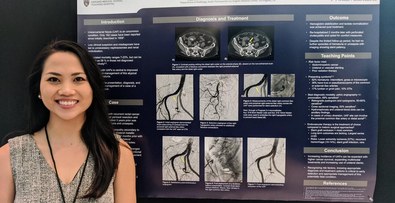 RSNA Poster